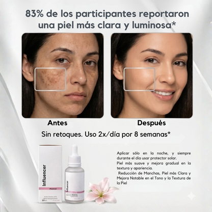Serum Acido Glicólico (Quita-Manchas)